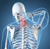 Mechanical Neck Pain