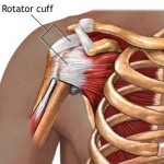 Rotator Cuff