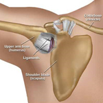 Shoulder Dislocation